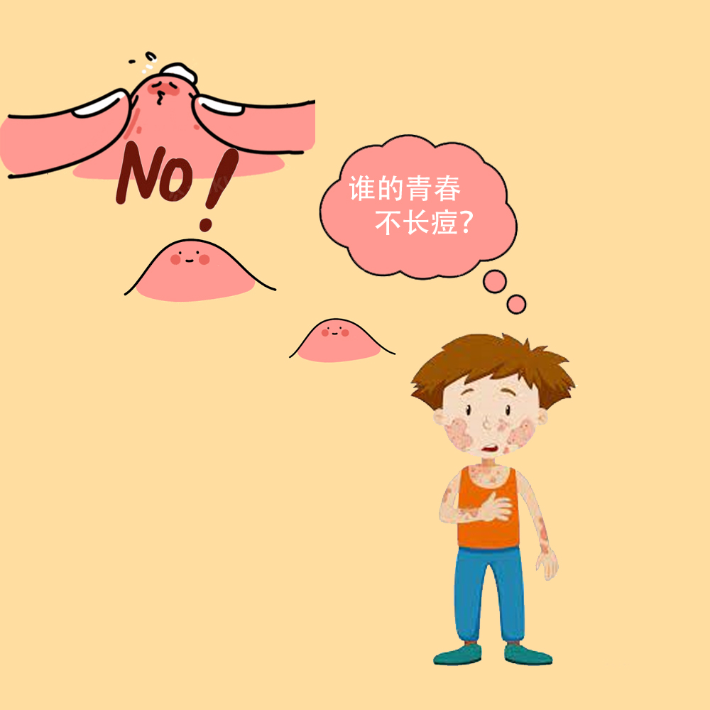 【015】誰的青春不長痘